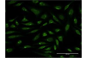 Immunofluorescence of monoclonal antibody to PIH1D1 on HeLa cell.