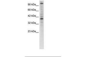 Image no. 1 for anti-Zinc Finger Protein 624 (ZNF624) (AA 499-548) antibody (ABIN6735933) (ZNF624 anticorps  (AA 499-548))