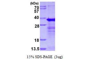Image no. 1 for RING1 and YY1 Binding Protein (RYBP) (AA 1-228) protein (His tag) (ABIN6386982)