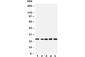 Western blot testing of SNRPN antibody and Lane 1:  rat kidney;  2: human U87;  3: (h) HeLa;  4: (h) HMY;  5: (m) NEUR cell lysate (SNRPN anticorps  (N-Term))