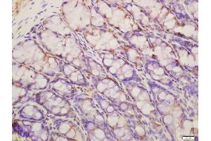 Formalin-fixed and paraffin embedded rat colon labeled with Anti-phospho-IRAK4(Thr345)Polyclonal Antibody, Unconjugated (ABIN753538) at 1:200 followed by conjugation to the secondary antibody and DAB staining