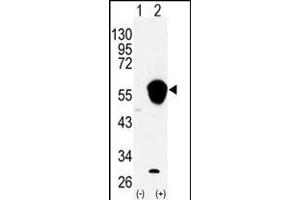 Western blot analysis of ALDH3A1 (arrow) using rabbit polyclonal ALDH3A1 Antibody (N-term) (ABIN392318 and ABIN2841969).