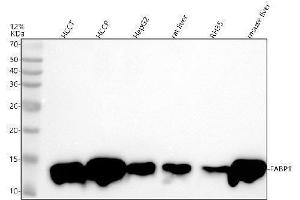 Western blot analysis of FABP1/L using anti-FABP1/L antibody (ABIN7604804).