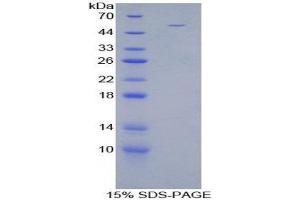 SDS-PAGE (SDS) image for Stanniocalcin 1 (STC1) (AA 28-247) protein (His tag,GST tag) (ABIN1880005) (Stanniocalcin 1 Protein (STC1) (AA 28-247) (His tag,GST tag))