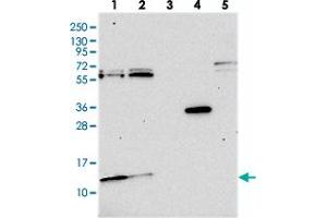 Western blot analysis of Lane 1: RT-4, Lane 2: U-251 MG, Lane 3: Human Plasma, Lane 4: Liver, Lane 5: Tonsil with MRP63 polyclonal antibody . (MRP63 anticorps)