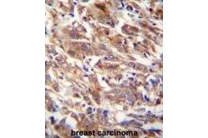 Immunohistochemistry (IHC) image for anti-F-Box and WD Repeat Domain Containing 12 (FBXW12) antibody (ABIN2995589)