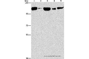 Western blot analysis of Raji cell and human fetal liver tissue, NIH/3T3 cell and mouse brain tissue, hela cell, using DNM2 Polyclonal Antibody at dilution of 1:400 (DNM2 anticorps)