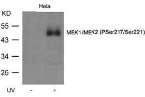 Image no. 1 for anti-Mitogen-Activated Protein Kinase Kinase 1 (MAP2K1) (pSer218), (pSer221) antibody (ABIN196944) (MEK1 anticorps  (pSer218, pSer221))