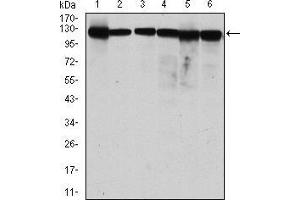 Western blot analysis using MCM2 mouse mAb against MCF-7 (1), Hela (2), Jurkat (3), K562 (4), HEK293 (5) and HEPG2 (6) cell lysate. (MCM2 anticorps)