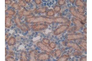 Detection of VIP in Rat Kidney Tissue using Polyclonal Antibody to Vasoactive Intestinal Peptide (VIP)