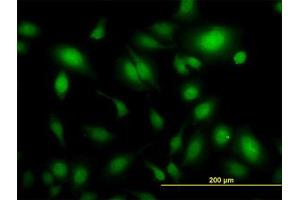 Image no. 1 for anti-Ubiquitin Specific Peptidase 34 (USP34) (AA 3296-3396) antibody (ABIN599094) (USP34 anticorps  (AA 3296-3396))
