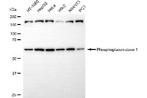 anti-Phosphoglucomutase 1 (PGM1) antibody