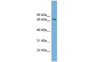 WB Suggested Anti-Ifi204 Antibody Titration:  0. (Ifi204 anticorps  (Middle Region))