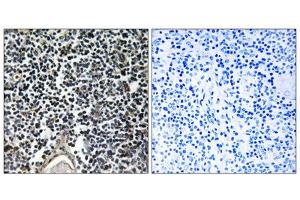Immunohistochemistry analysis of paraffin-embedded human thymus gland tissue, using ABCB7 antibody. (ABCB7 anticorps  (C-Term))