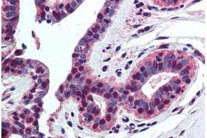 Human Breast (formalin-fixed, paraffin-embedded) stained with Histone H4 antibody ABIN294329 at 5 ug/ml followed by biotinylated goat anti-rabbit IgG secondary antibody ABIN481713, alkaline phosphatase-streptavidin and chromogen. (Histone H4 anticorps  (AA 15-30))