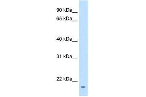 WB Suggested Anti-FAM107A Antibody Titration:  1 ug/ml  Positive Control:  Transfected 293T (FAM107A anticorps  (Middle Region))