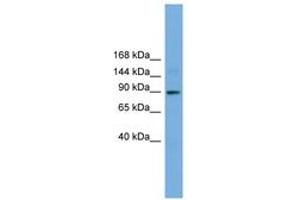 Image no. 1 for anti-Tetratricopeptide Repeat Domain 27 (TTC27) (AA 251-300) antibody (ABIN6745624) (TTC27 anticorps  (AA 251-300))
