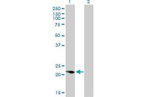 Western Blot analysis of CAPS expression in transfected 293T cell line by CAPS monoclonal antibody (M01), clone 4C6. (Calcyphosine anticorps  (AA 1-109))