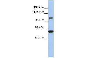 Human HeLa; WB Suggested Anti-ZSCAN20 Antibody Titration: 0. (ZSCAN20 anticorps  (Middle Region))
