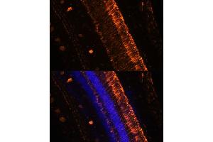 Immunofluorescence analysis of mouse eye using KCNS2 Polyclonal Antibody (ABIN7269478) at dilution of 1:100 (20x lens).