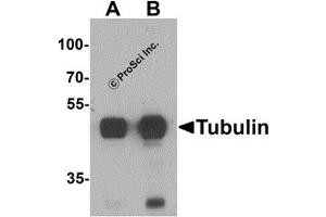 Western Blotting (WB) image for anti-alpha Tubulin (TUBA1) (N-Term) antibody (ABIN1077421) (alpha Tubulin anticorps  (N-Term))