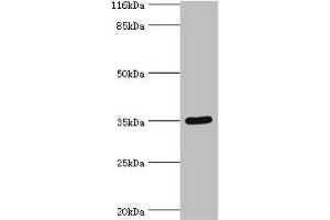 Western blot All lanes: SULT1B1 antibody at 24 μg/mL + Mouse small intestine tissue Secondary Goat polyclonal to rabbit IgG at 1/10000 dilution Predicted band size: 35 kDa Observed band size: 35 kDa (SULT1B1 anticorps  (AA 1-271))
