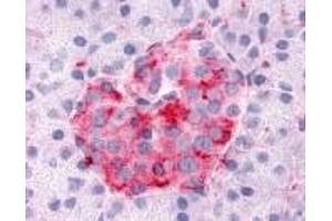 Immunohistochemistry (IHC) image for anti-serum/glucocorticoid Regulated Kinase Family, Member 3 (SGK3) (N-Term) antibody (ABIN2469461)