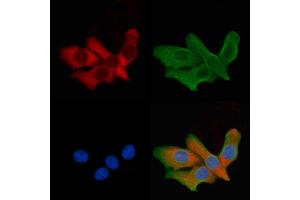 ABIN6260012 and ABIN6279137 staining HepG2 cells by IF/ICC. (AQP6 anticorps  (Internal Region))