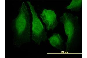 anti-Calcium/calmodulin-Dependent Protein Kinase II beta (CAMK2B) (AA 405-502) antibody
