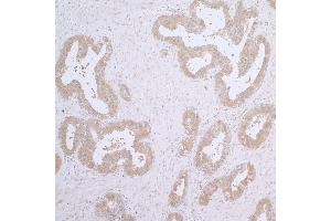 Immunohistochemistry (IHC) image for anti-Chaperonin Containing TCP1, Subunit 7 (Eta) (CCT7) (AA 1-50) antibody (ABIN7453931)