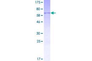 Image no. 1 for Hydroxy-delta-5-Steroid Dehydrogenase, 3 beta- and Steroid delta-Isomerase 1 (HSD3B1) (AA 1-373) protein (GST tag) (ABIN1307142)