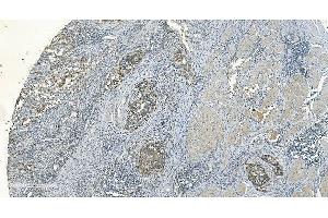 IHC analysis of IDH2 using anti-IDH2 antibody (ABIN7602786). (IDH2 anticorps  (C-Term))
