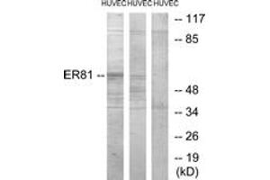 Western Blotting (WB) image for anti-Ets Variant 1 (ETV1) (AA 10-59) antibody (ABIN2889499) (ETV1 anticorps  (AA 10-59))