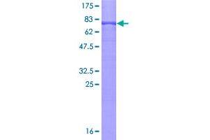Image no. 1 for Inositol Hexakisphosphate Kinase 2 (IP6K2) (AA 1-426) protein (GST tag) (ABIN1308004)
