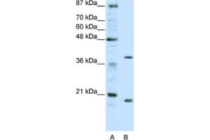 Western Blotting (WB) image for anti-Zinc Finger Protein 322A (ZNF322A) antibody (ABIN2461934) (ZNF322A anticorps)