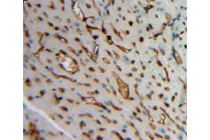 Used in DAB staining on fromalin fixed paraffin-embedded heart tissue (Angiopoietin 4 anticorps  (AA 270-490))