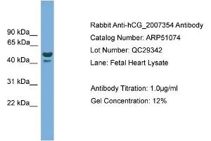 WB Suggested Anti-hCG_2007354  Antibody Titration: 0. (hCG_2007354 (N-Term) anticorps)