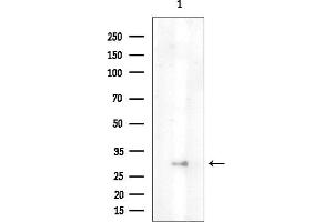 Western blot analysis of lysates from EC304 cells(heat-shock treatment), using OR13G1 Antibody at 1/1000 dilution.