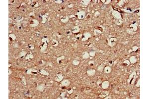 Immunohistochemistry of paraffin-embedded human brain tissue using ABIN7161445 at dilution of 1:100