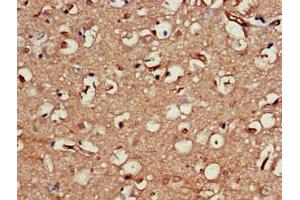 Immunohistochemistry of paraffin-embedded human brain tissue using ABIN7161445 at dilution of 1:100 (Neuroserpin anticorps  (AA 191-240))