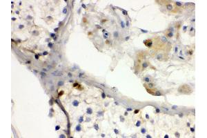 Anti- DMRT1 antibody,IHC(P) IHC(P): Human Testis Tissue (DMRT1 anticorps  (N-Term))
