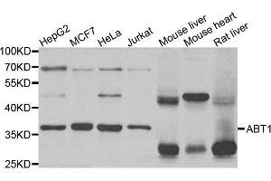 Western Blotting (WB) image for anti-Activator of Basal Transcription 1 (Abt1) antibody (ABIN1876937)