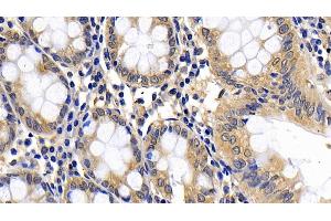 Detection of Bid in Human Colon Tissue using Polyclonal Antibody to BH3 Interacting Domain Death Agonist (Bid) (BID anticorps  (AA 1-195))