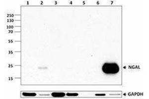 Western Blotting (WB) image for anti-Lipocalin 2 (LCN2) antibody (ABIN2665287) (Lipocalin 2 anticorps)