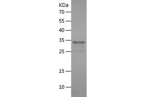 Western Blotting (WB) image for Hydroxysteroid (17-Beta) Dehydrogenase 3 (HSD17B3) (AA 67-178) protein (His-IF2DI Tag) (ABIN7123390)