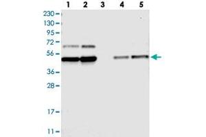 Western blot analysis of Lane 1: RT-4, Lane 2: U-251 MG, Lane 3: Human Plasma, Lane 4: Liver, Lane 5: Tonsil with FAM172A polyclonal antibody  at 1:250-1:500 dilution. (Fam172a anticorps)