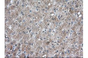 Immunohistochemical staining of paraffin-embedded Human prostate tissue using anti-BCL10 mouse monoclonal antibody. (BCL10 anticorps)