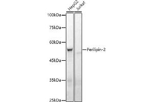 Western blot analysis of extracts of various cell lines, using Perilipin-2 antibody (ABIN7269220) at 1:1000 dilution.