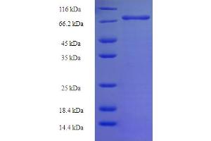 SDS-PAGE (SDS) image for Notchless Homolog 1 (NLE1) (AA 2-485) protein (His-SUMO Tag) (ABIN5711937)