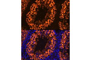 Immunofluorescence analysis of Rat testis cells using PIWIL1 antibody (ABIN3023049, ABIN3023050, ABIN3023051 and ABIN6219364) at dilution of 1:100. (PIWIL1 anticorps)